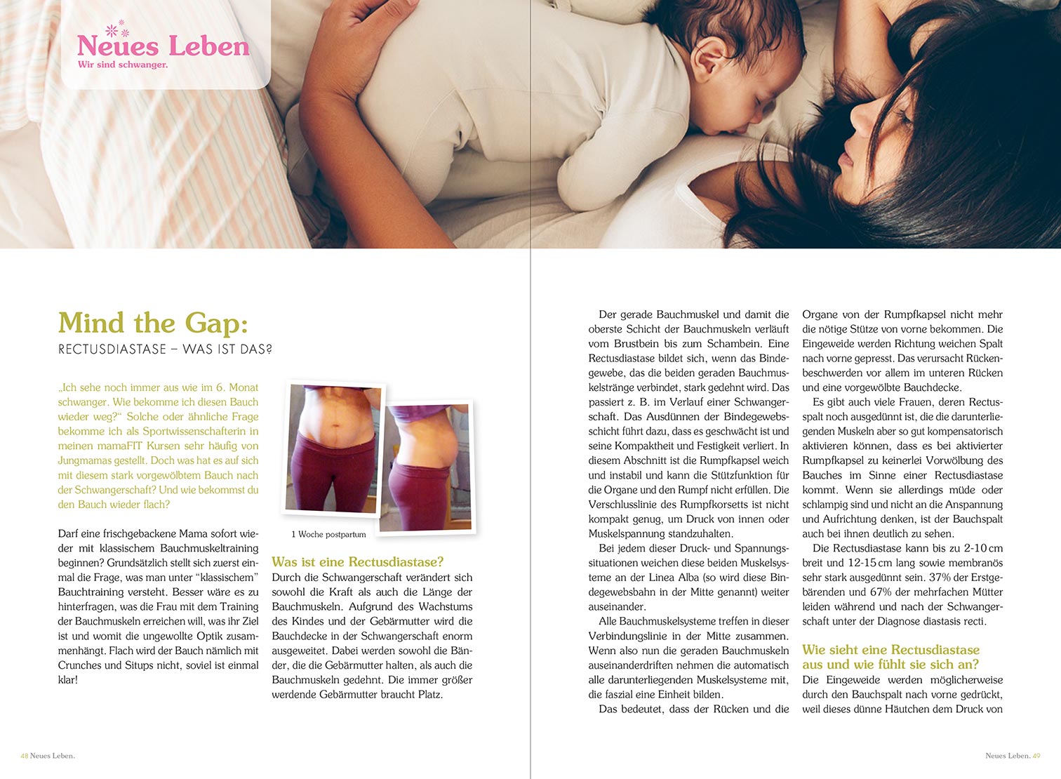 mamaFIT Artikel im Magazin Neues Leben - Wir sind schwanger. Mind the Gap: Rectusdiastase - Was ist das?
